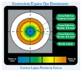 Corrección de la Presbicia, mediante lentes de contacto