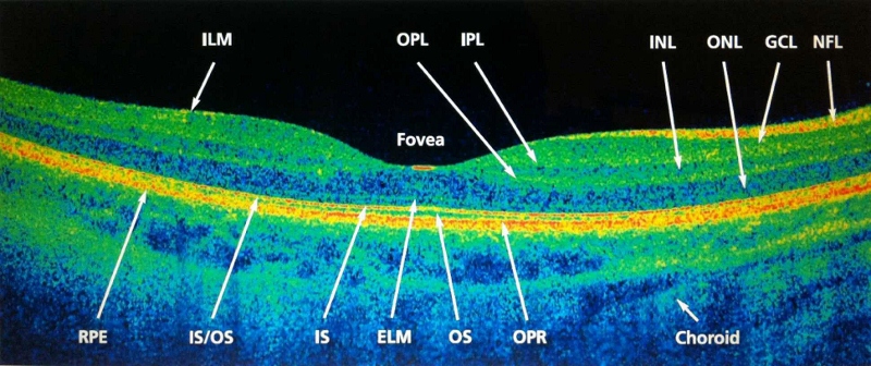 OCT: ¿Necesito dilatarme la pupila?