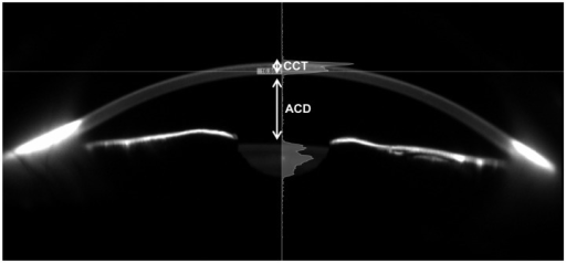 Resultado de imagen de central corneal thickness