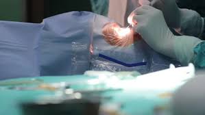 ¿Qué ven los Pacientes durante la Cirugía de Cataratas?