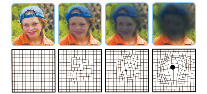 eye-vision-boy