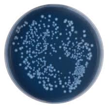 Qvision Orto-k: ¿Existe mayor riesgo de queratitis bacteriana? images 38