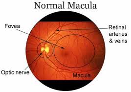 Glaucoma: Correlación entre espesor macular y campos visuales