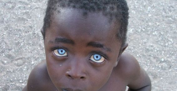 ¿POR QUE TENGO LOS OJOS  DE COLOR….?
