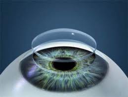 Los implantes cosméticos de iris (NewColorIris) pueden presentar muy serias complicaciones
