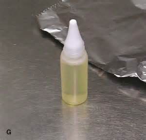 Suero autólogo