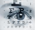 SUPRACOR: Corrección LASIK de la presbicia (vista cansada) (2/3)