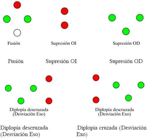 Visión Binocular: Parte I